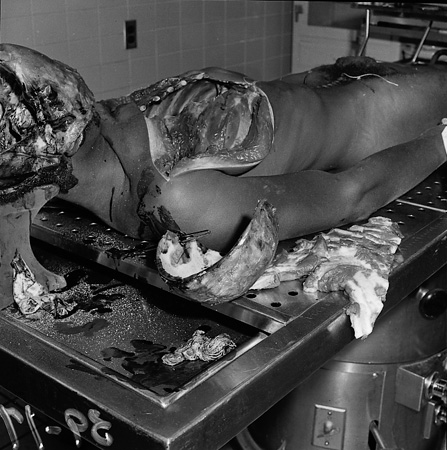 15_25_ autopsy_0352