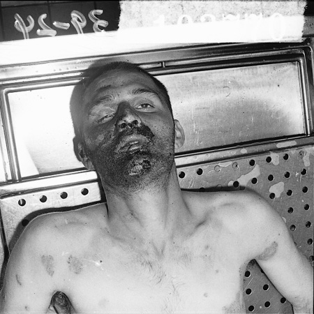 15_26_autopsy_bloody face_0353