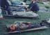 dhpm_man on stretcher copy